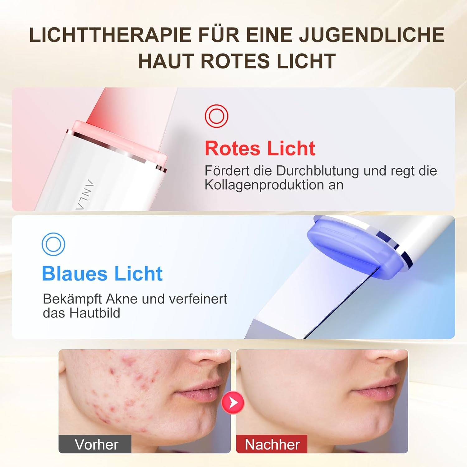 Ultraschallpeelinggerät Für Gesicht, ANLAN IPX7 Wasserdicht Ultraschall Skin Scrubber 6 in 1 Gesichtsreinigungsgerät Blau Rotlichtlampe Gesicht Porenreiniger Mit Type-C Ladebasis