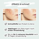 VIGOROUS® Zinksalbe Gegen Pickel 60Ml - anti Pickel Creme Auch Für Pickel Am Po Und Rücken -Mit Teebaumöl & Salicylsäure - SOS Zink Salbe Gegen Mitesser Und Unreine Haut - Zugsalbe Pickel - Akne Creme