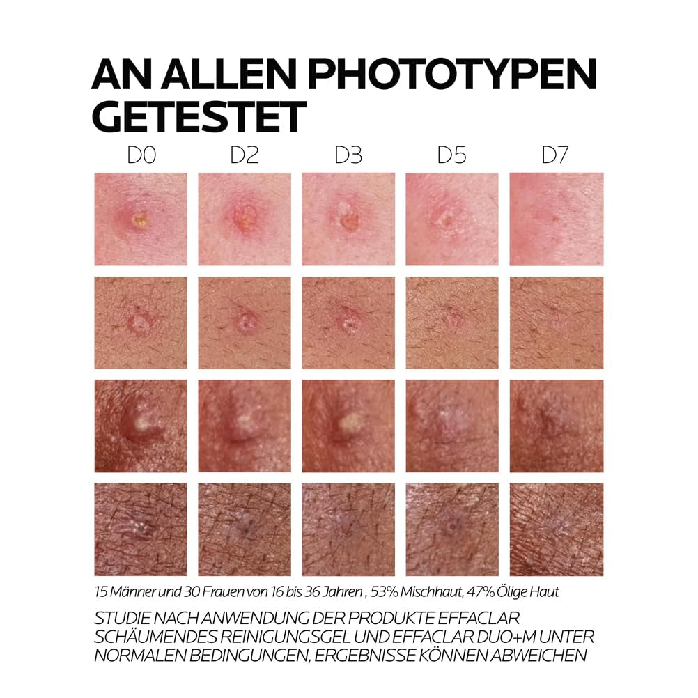 La Roche Posay Anti-Akne Gesichtscreme, Dreifach Tiefenwirksame Pflege Gegen Pickel, Mitesser Und Unreinheiten, Mit Anti-Rückfall-Effekt, Mit Niacinamid, Phylobioma Und Procerad, Effaclar Duo+M, 40 Ml