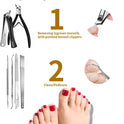Entfernungsset Für Eingewachsene Zehennägel, 6 Stück, Edelstahl, Gerade, Schräge Und Gebogene Nagelknipser Für Eingewachsene Nägel, Professionelles Pediküre-Werkzeug Zu Hause