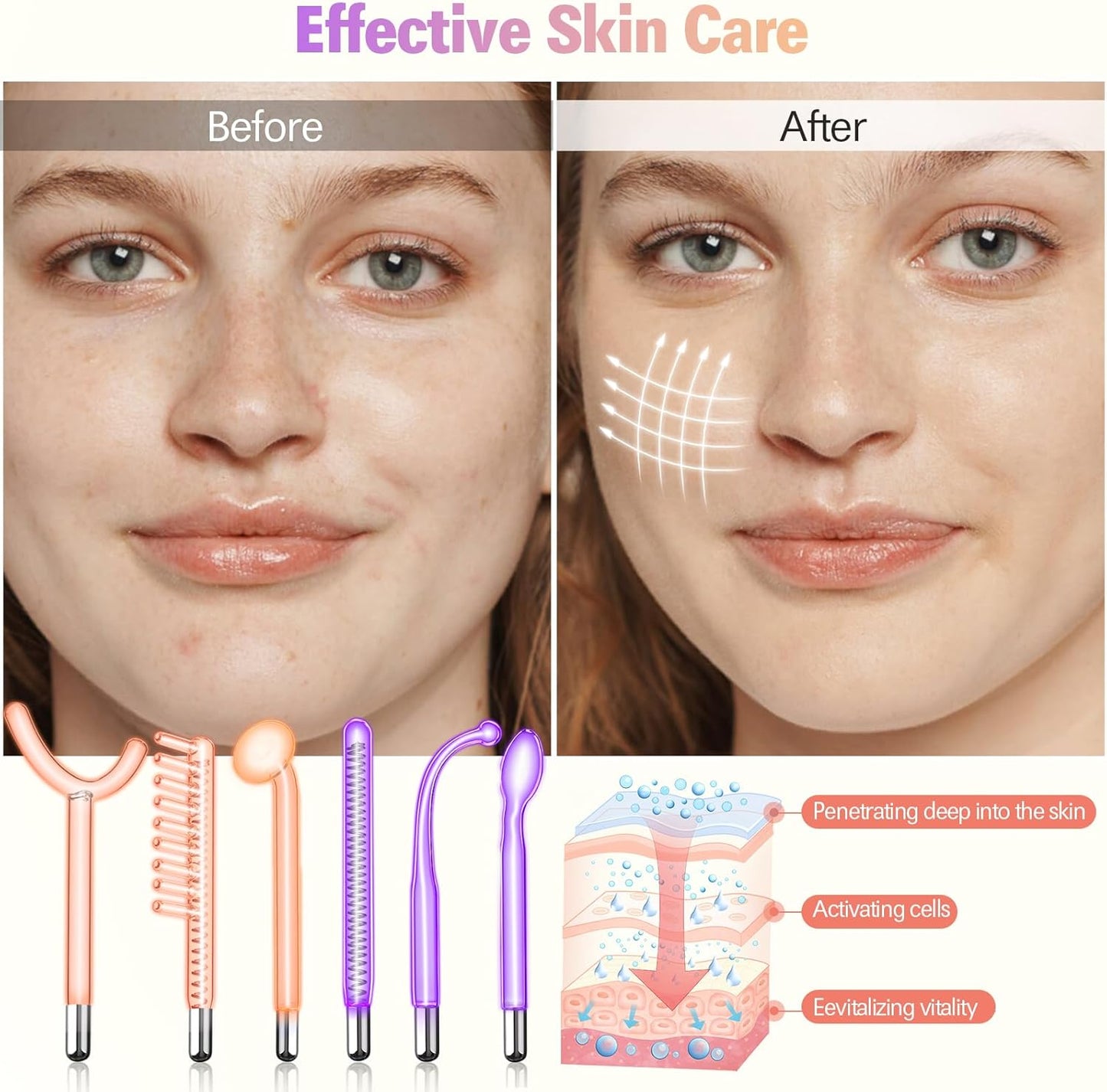 Hochfrequenz Gesichtsmaschine 6 PC, Neongasstäbe Und Argongasstäbe Schönheitsgerät Für Die Hautpflege, Aknebehandlung, Hautstraffung, Faltenreduzierung, Gesichtsreiniger