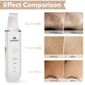 Skin Scrubber Face Skin Spatula Ultraschallpeelinggerät Skin Scrubber Mitesserentferner Porenreiniger Werkzeug Mitesser-Extraktor Für Tiefenreinigung