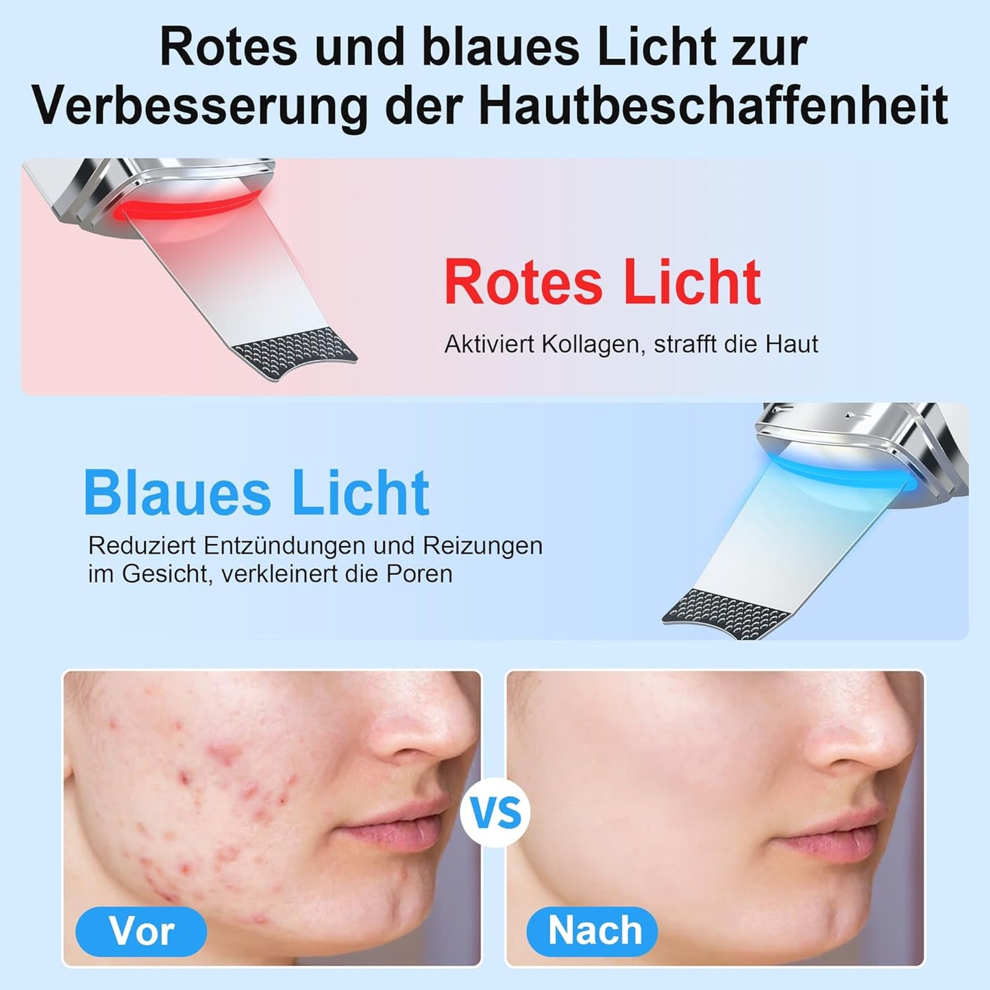Skin Scrubber Ultraschall, Porenreiniger Gesicht Mit 4 Modi Und Einstellbarer Intensitä, Rotes Blaues Licht, Led-Anzeige Und 5-Minuten-Autoabschaltung Mitesserentferner Gesichtsreinigung Gerät