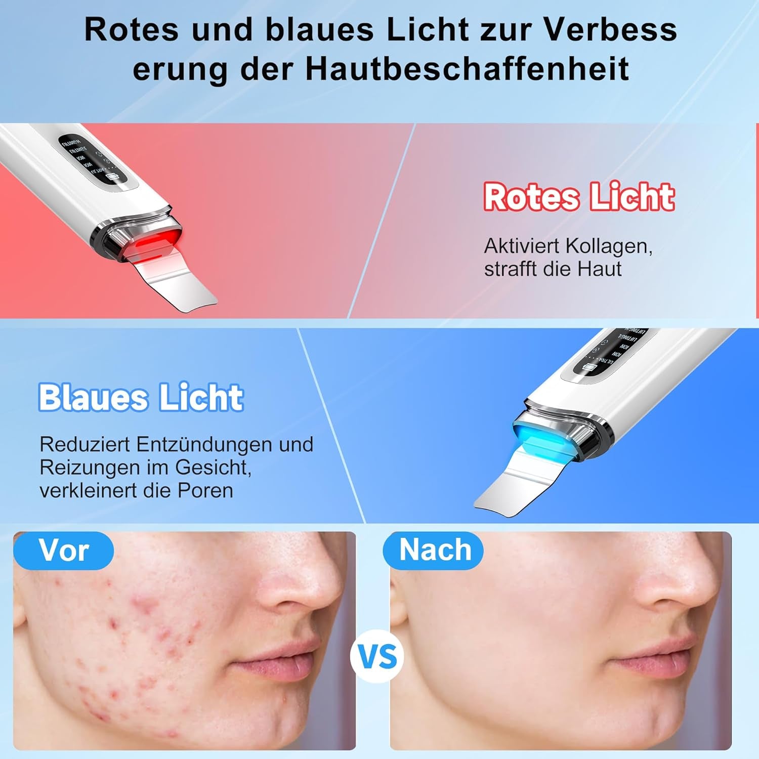 Skin Scrubber Ultraschall, Porenreiniger Gesicht Mit 4 Modi Und IPX7 Wasserdicht, Rotes Blaues Licht, Led-Anzeige Und 5-Minuten-Autoabschaltung Mitesserentferner Gesichtsreinigung Gerät