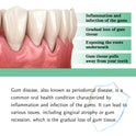 Gum Care Drops Care For Gums Relieve Bubbling Oral Cleansing Drops