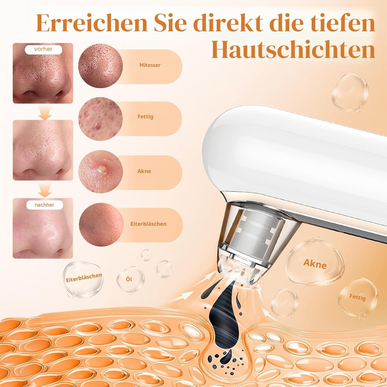 Mitesserentferner Porenreiniger Porensauger 4 Modi Pickelsauger Vakuumsauger Zur Gesichtsreinigung Akne Behandlung Mitesser Sauger Hautpflege